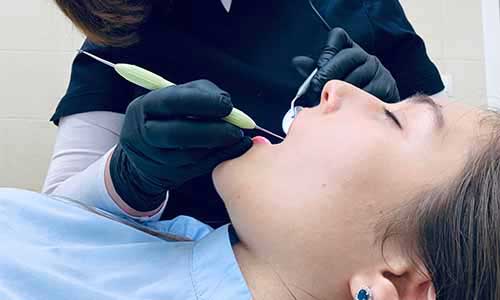 Clear aligner consultation in Pune