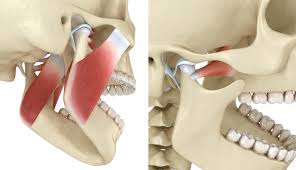 TMJ Joint Pain